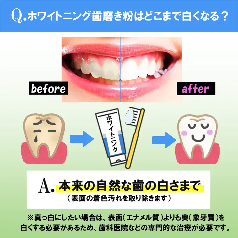 ホワイトニング歯磨き粉はどこまで白くなる?